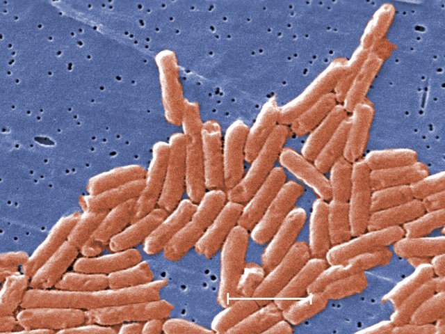 Deadly Salmonella outbreak linked to a variety of raw turkey products; 164 people sick in 35 states